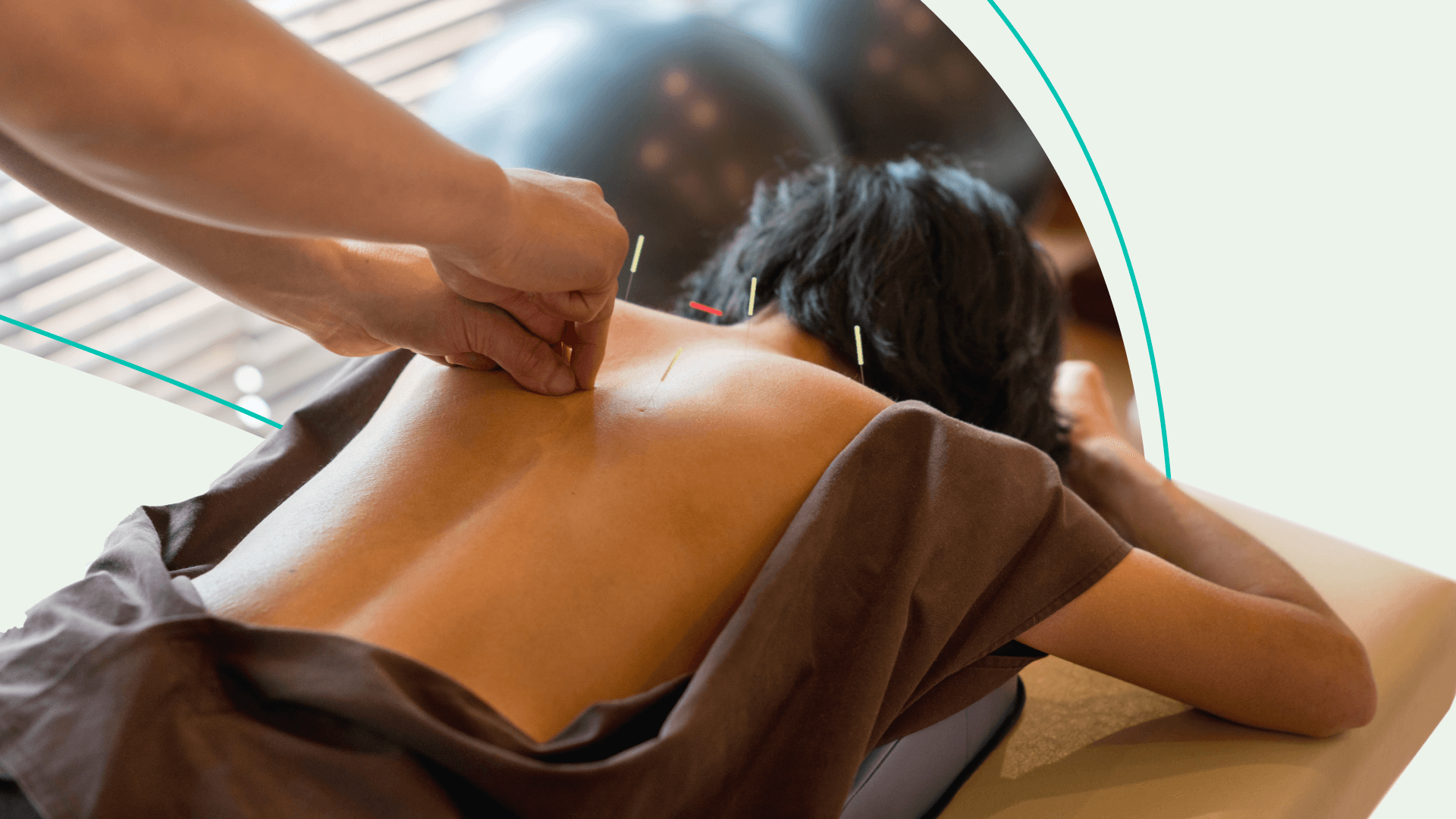 Woman with Needles Being Put in Back