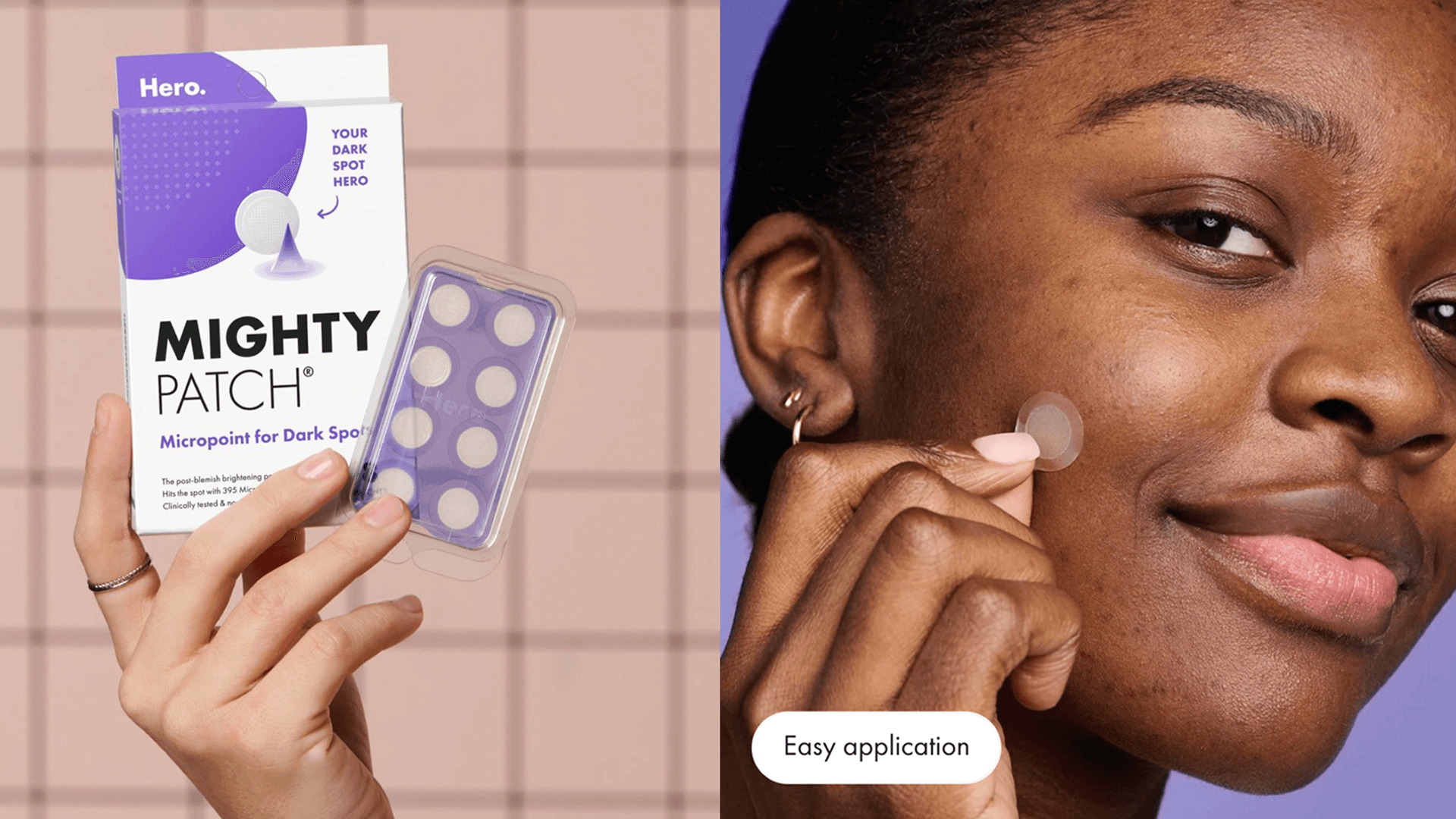 pimple patches