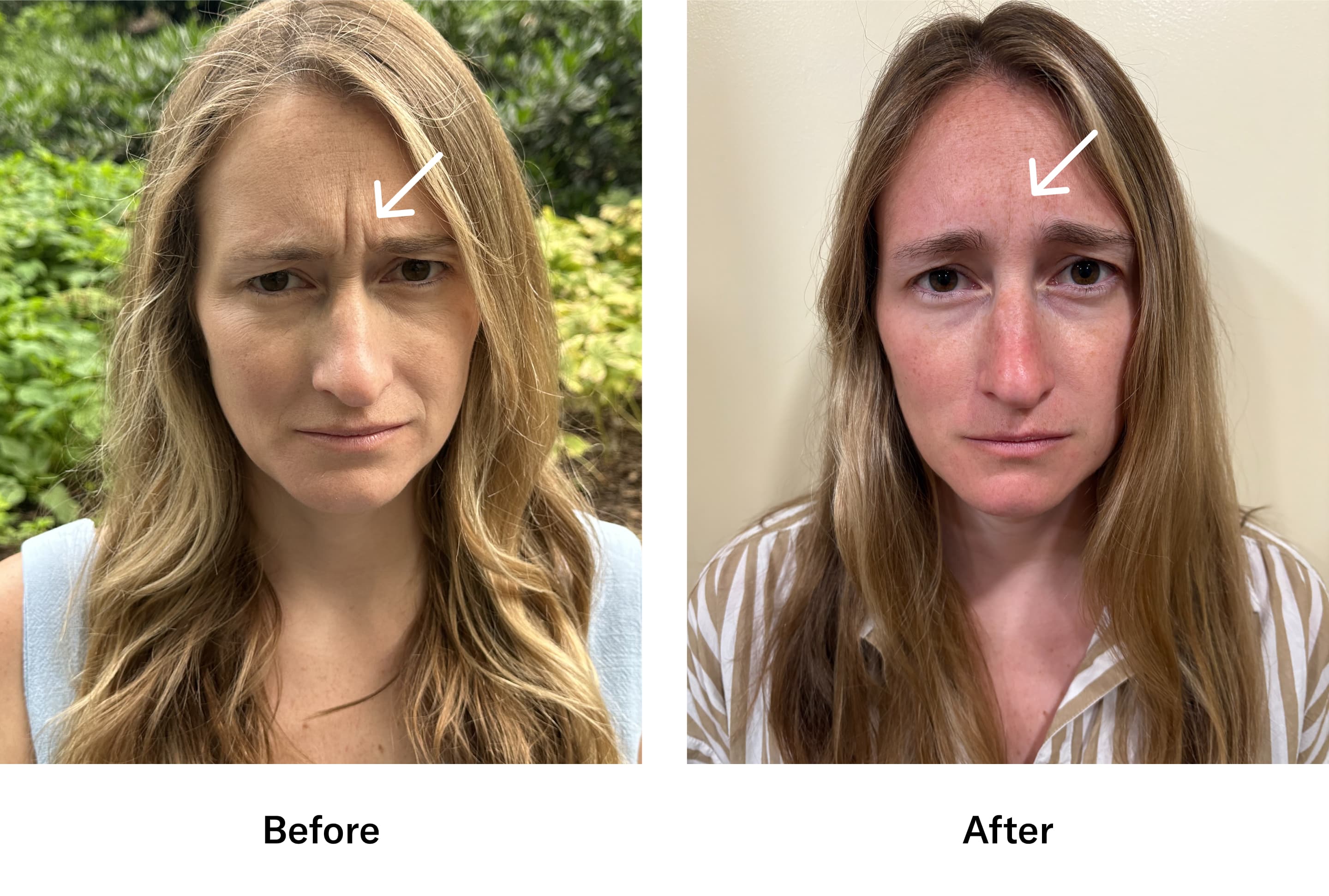 Sarah before and after