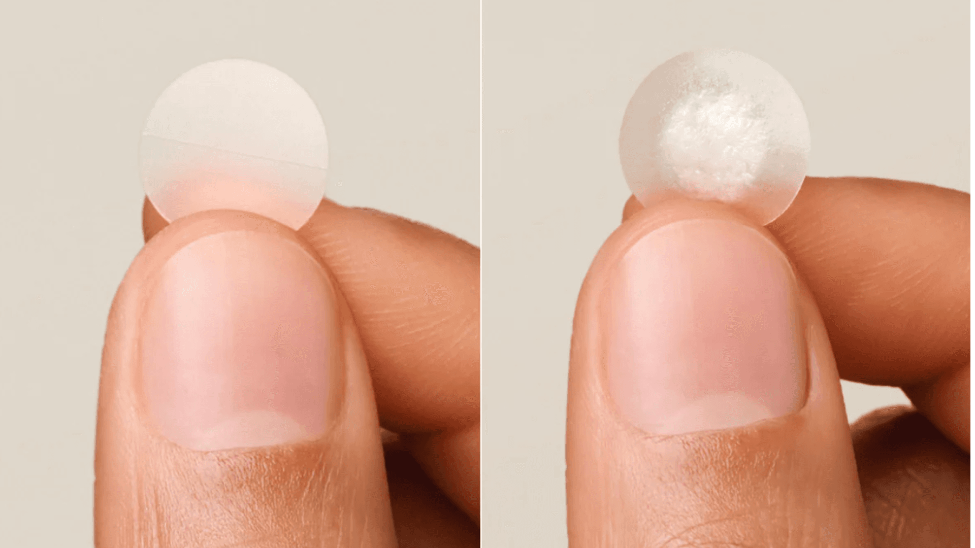 pimple patches