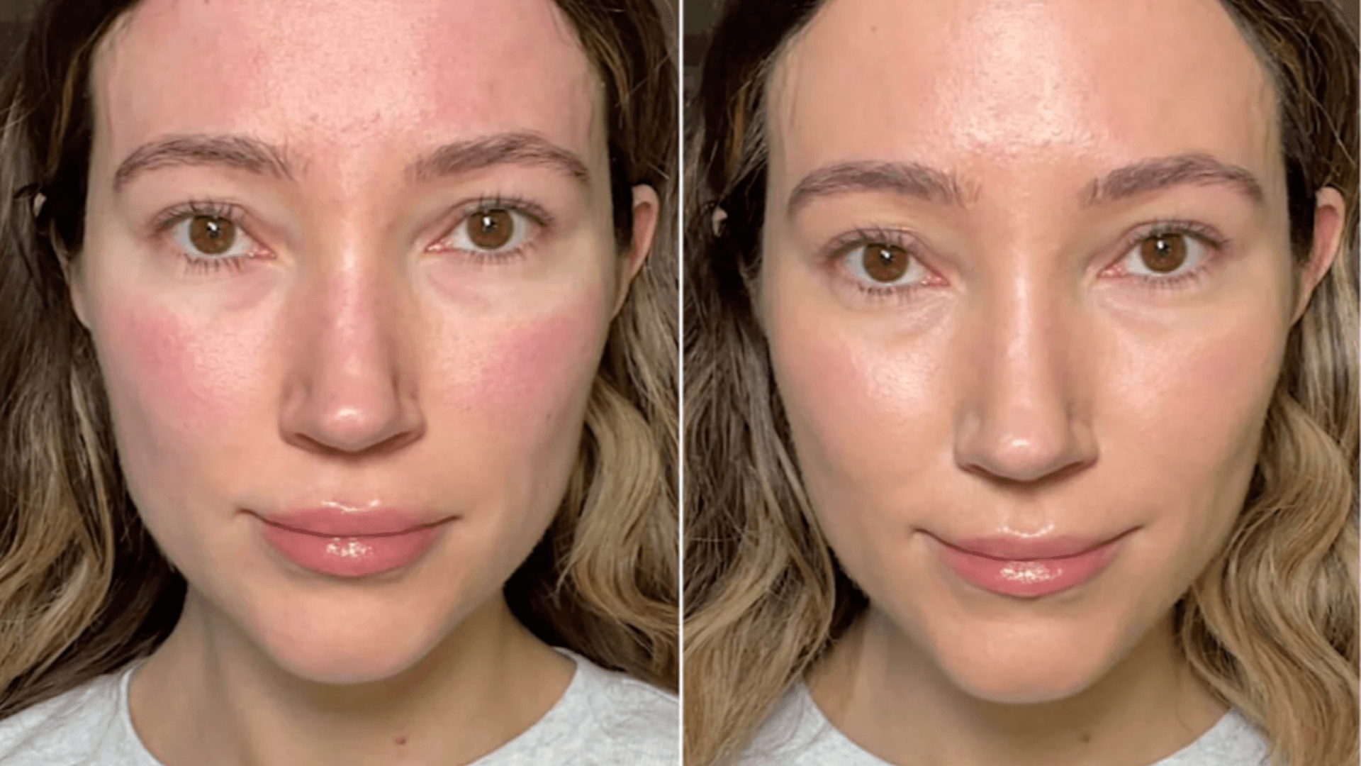 face cream